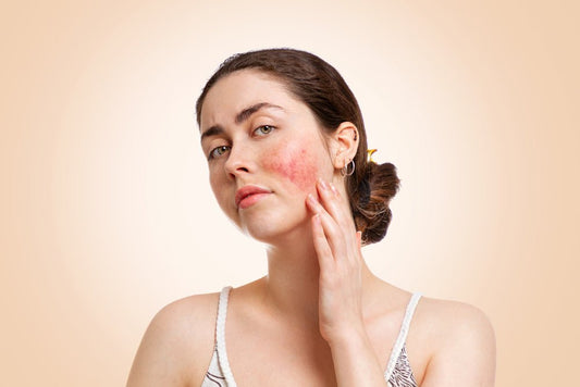 Compromised Skin Barrier: What It Is And Why You Should Care - Bee Naturals Store