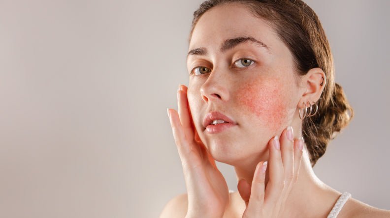 Skin Concerns - Redness & Inflammation - Bee Naturals 