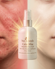 Calm Mist - Hypochlorous Acid Spray for Face | Calms Acne, Rosacea & Eczema | Sensitive Skin Facial Toner Mist | Fragrance - Free, Dermatologist Tested | 4 fl oz