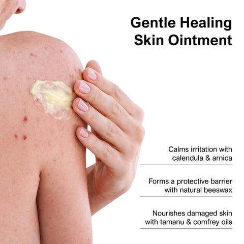 Herbal Antiseptic Ointment