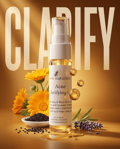 Acne-Clarifying Facial Oil