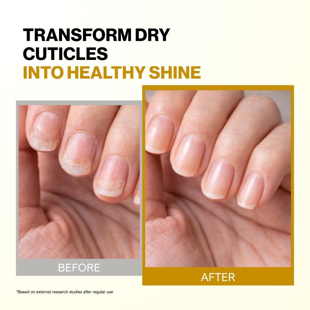 Bee Naturals Cuticle and Nail Oil